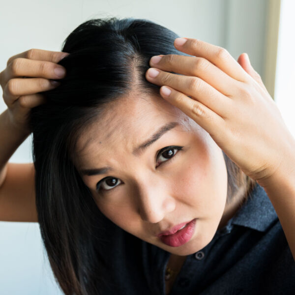 Asian woman experiencing hair loss