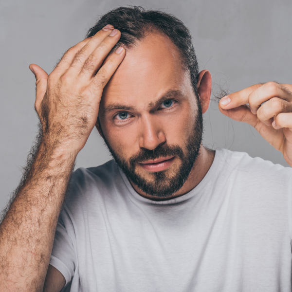 Bearded,Middle,Aged,Man,Holding,Fallen,Hair,And,Looking,At