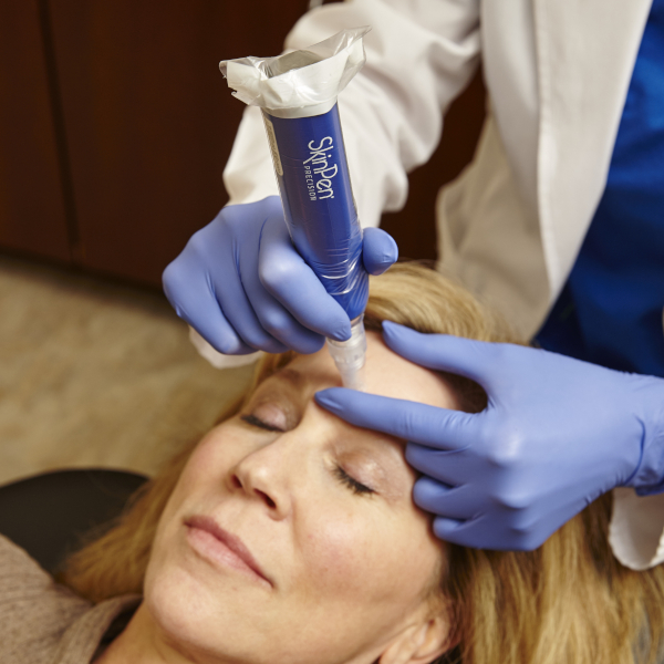 Woman receiving SkinPen with PRP treatment or vampire facial